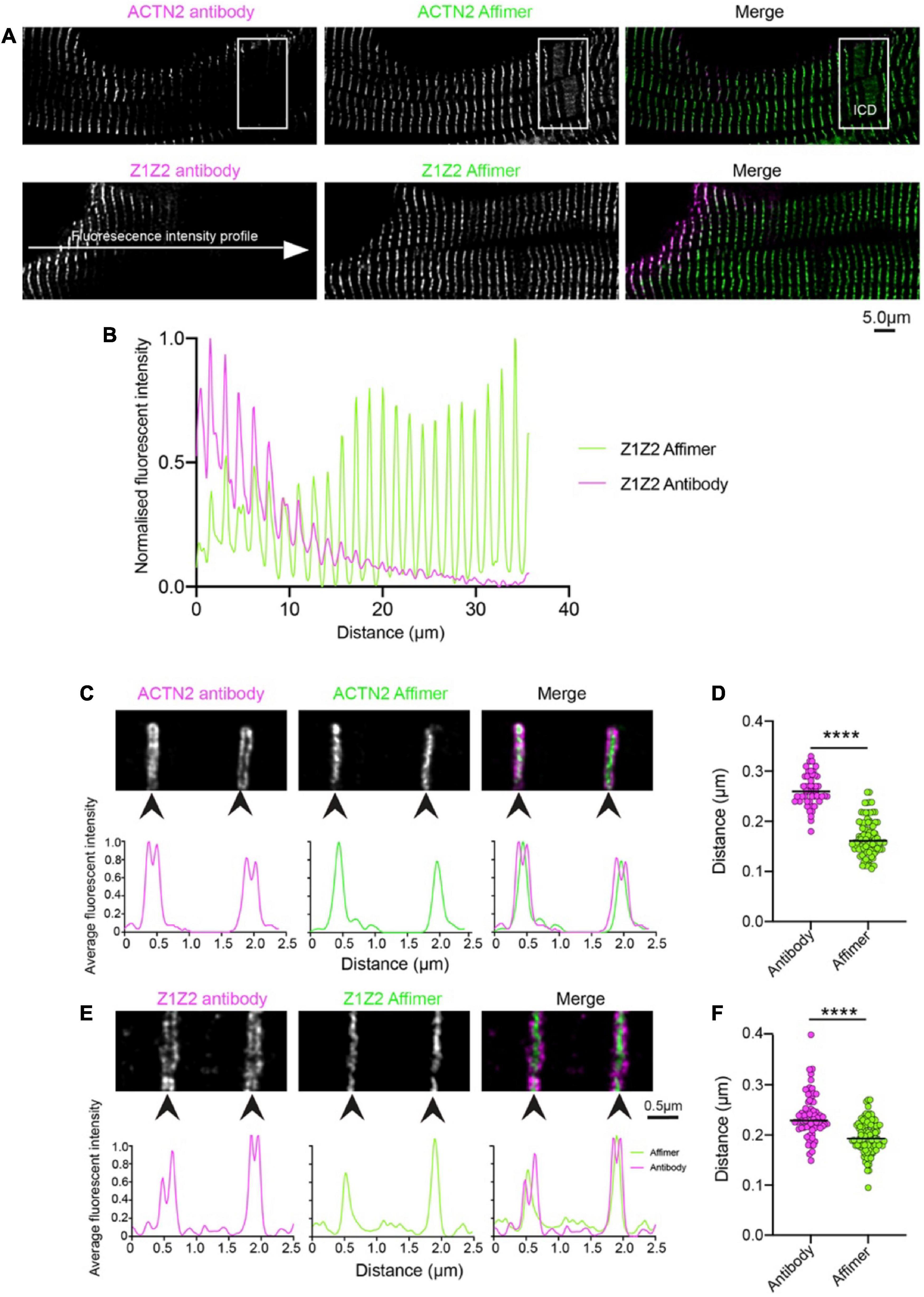 Affimers targeting proteins in the cardiomyocyte Z-disc: Novel tools that improve imaging of heart tissue